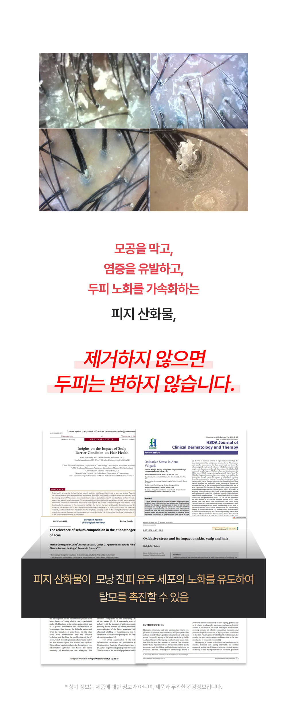 포셰리 비울 두피스케일러