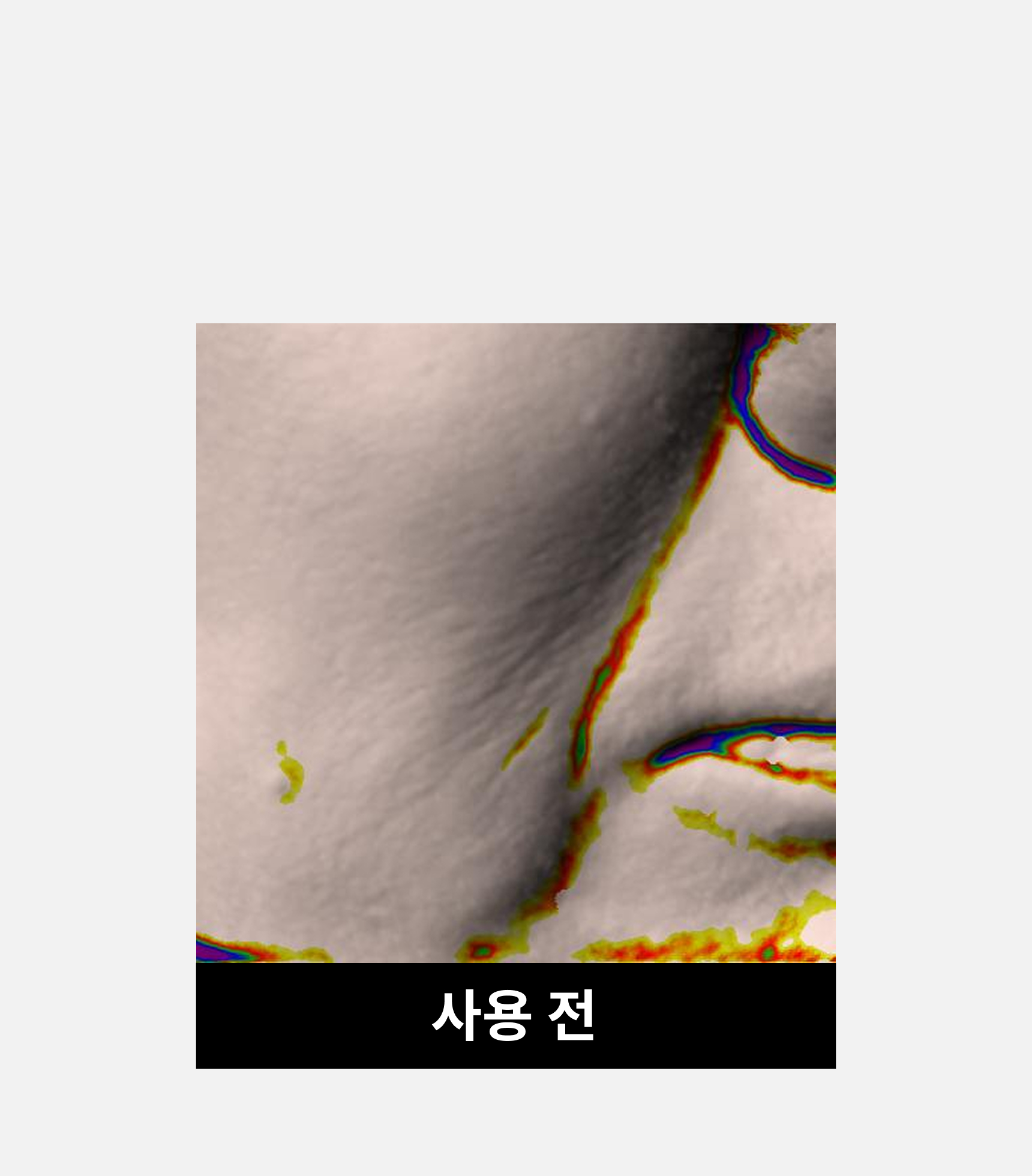 온슬로 레티놀 팔자주름패치_,0.1g*5, 40매