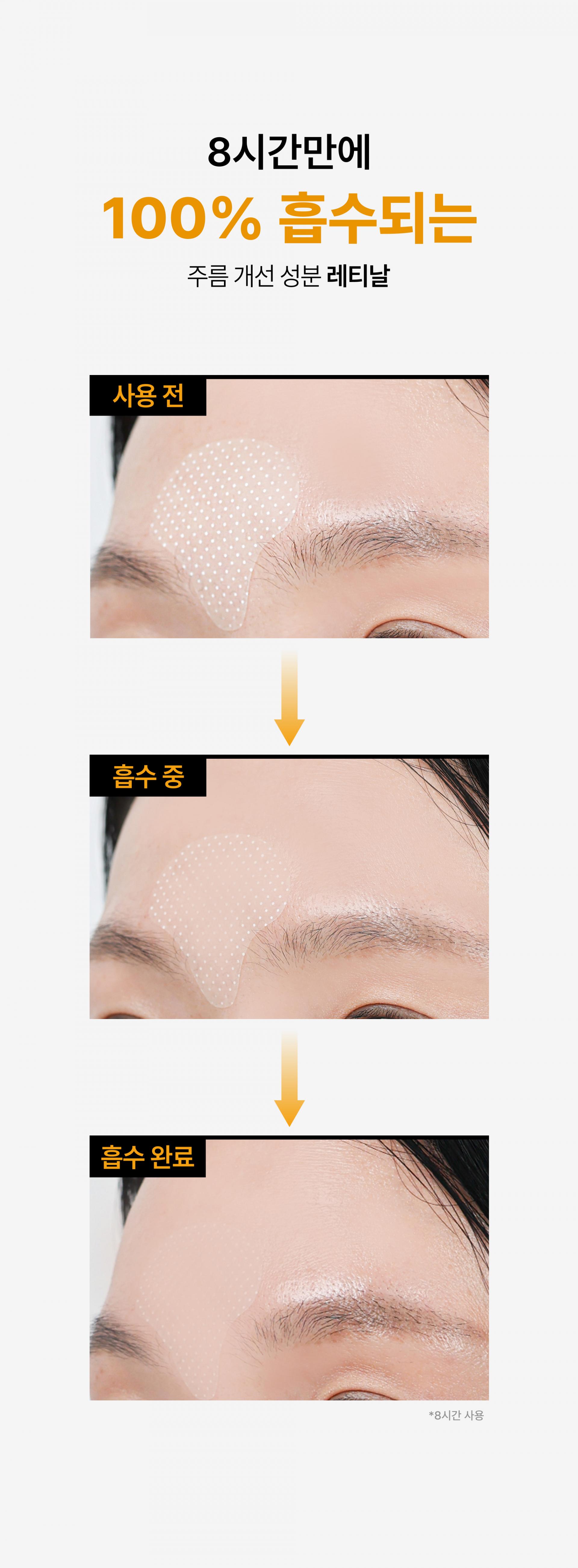 온슬로 레티날 미간주름패치_0.28g*5, 45매