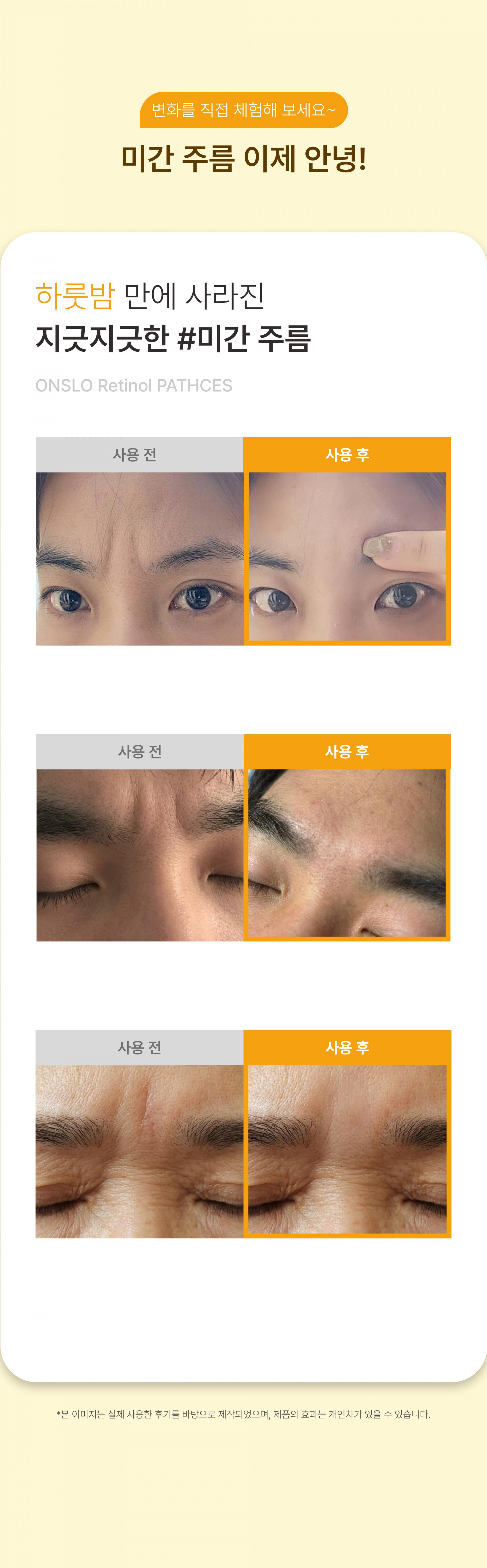 온슬로 레티날 미간주름패치_0.28g*5, 45매