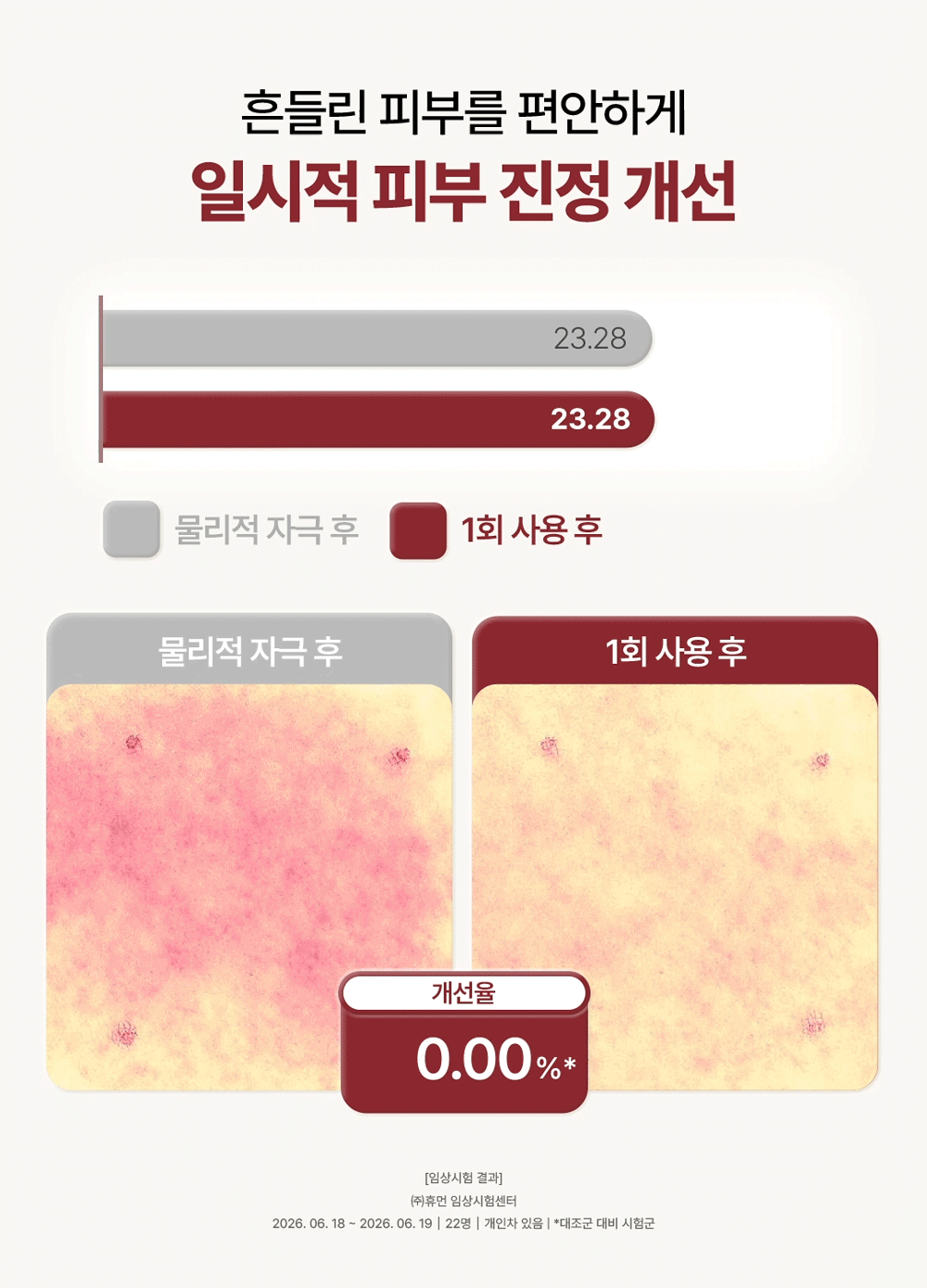 피코덤 NAD+ 리포좀 크림