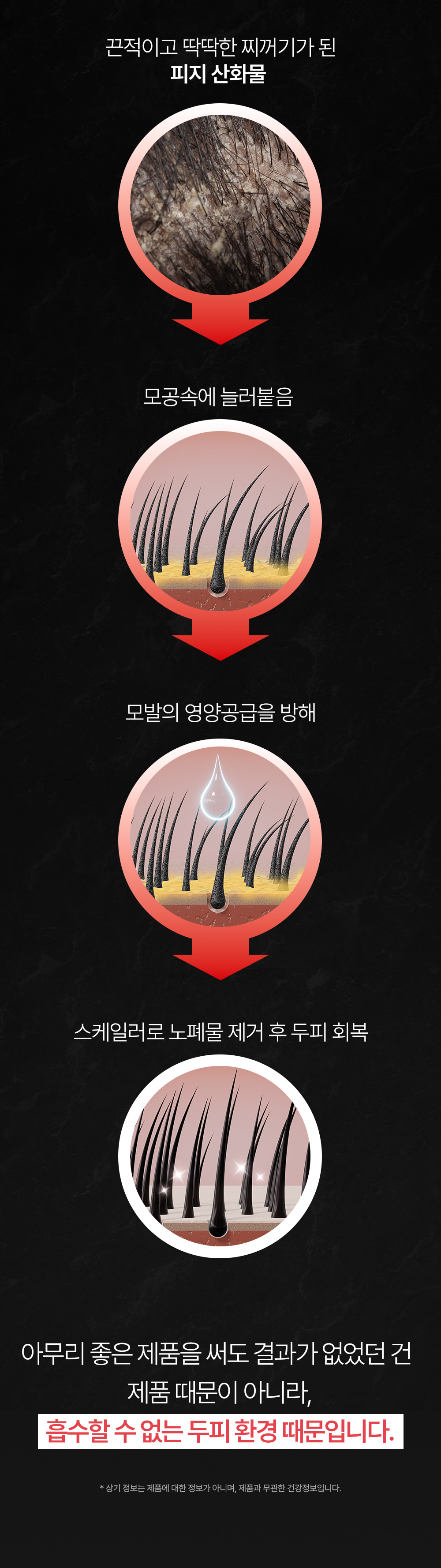 포셰리 비울 두피스케일러
