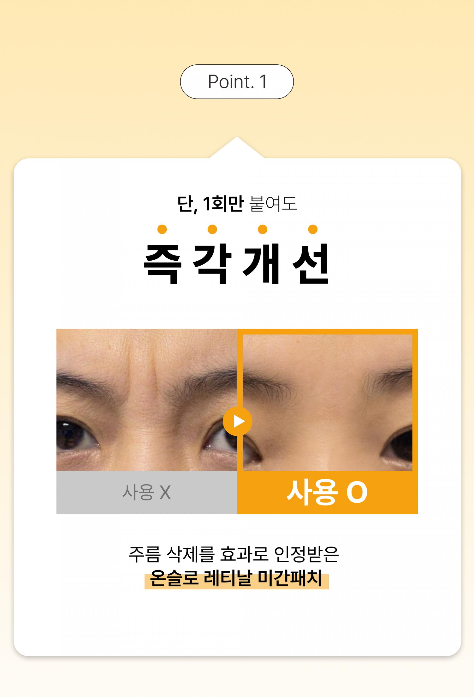 온슬로 레티날 미간주름패치_0.28g*5, 45매