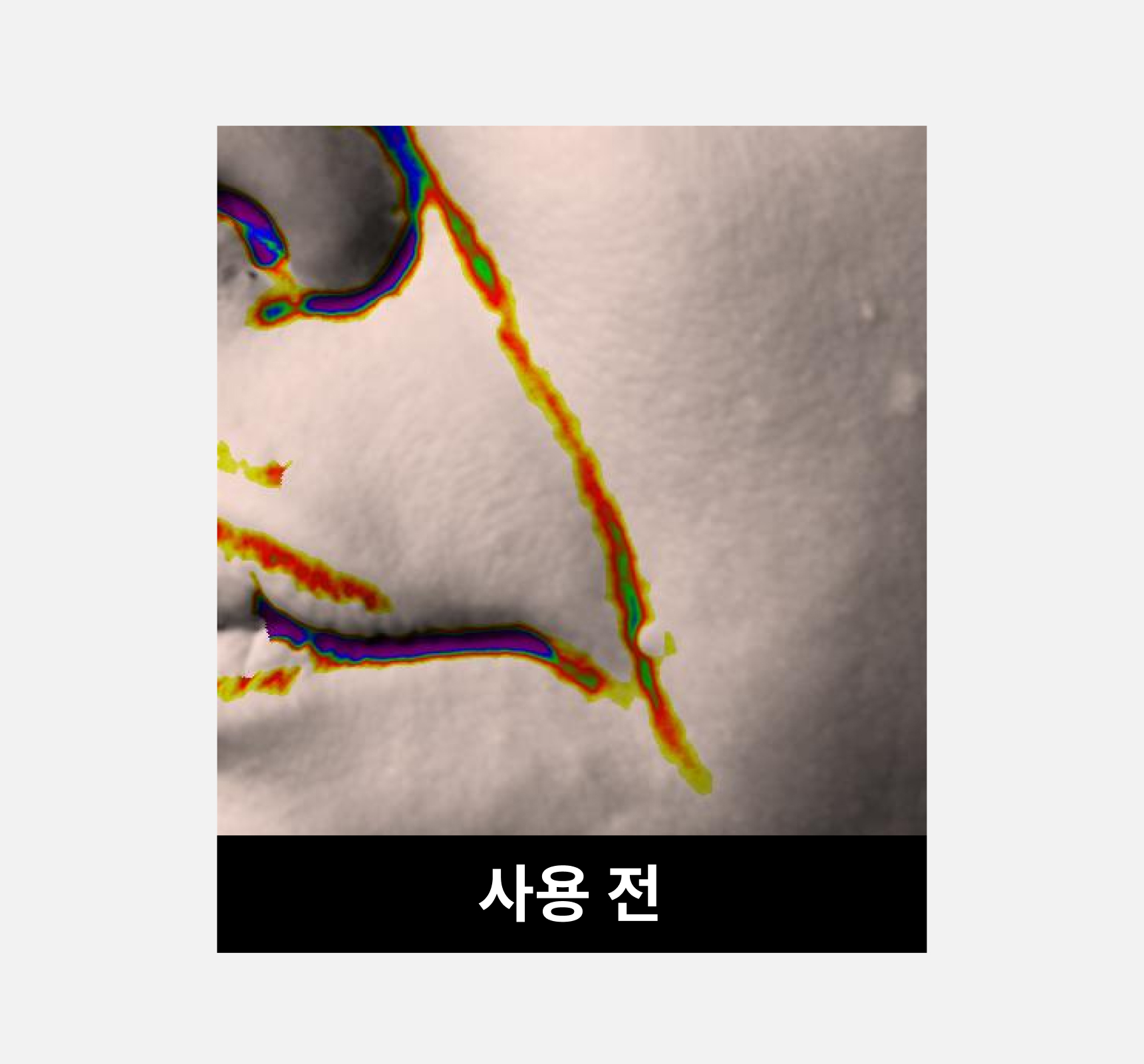 온슬로 레티놀 팔자주름패치_,0.1g*5, 40매