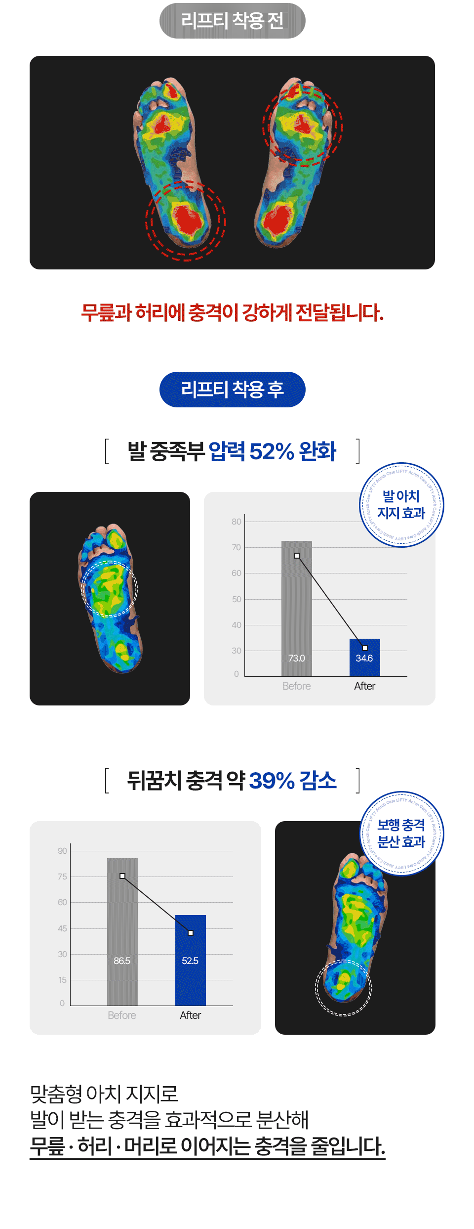 리프티 아치케어