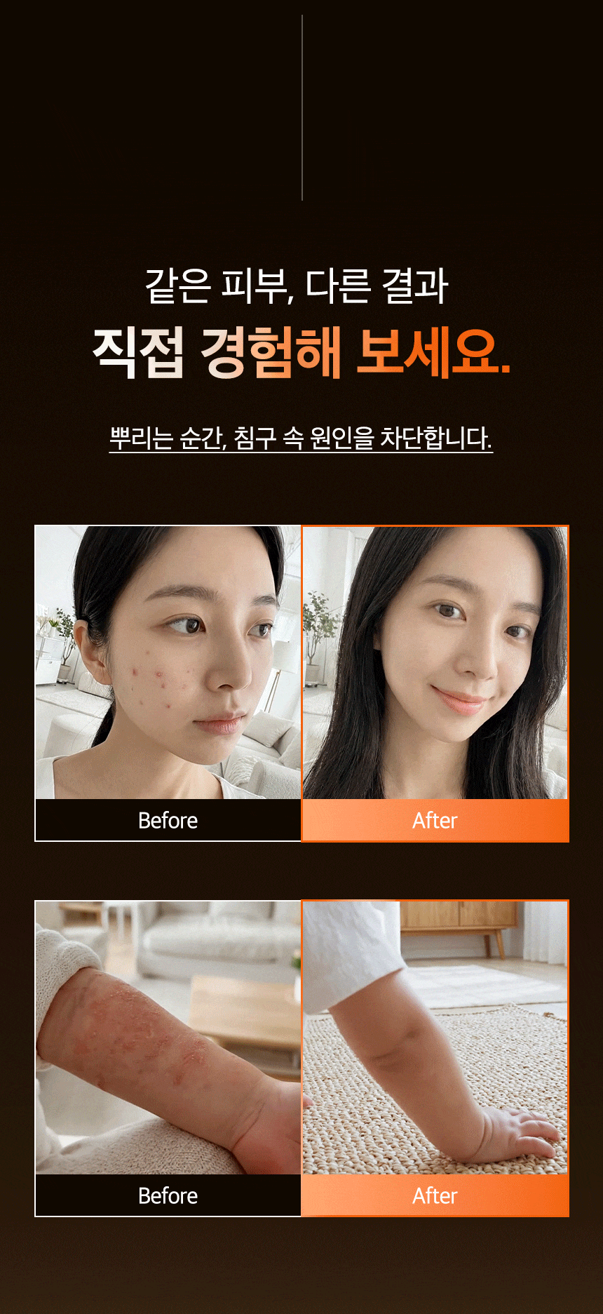 버그넷 티트리 베드샷