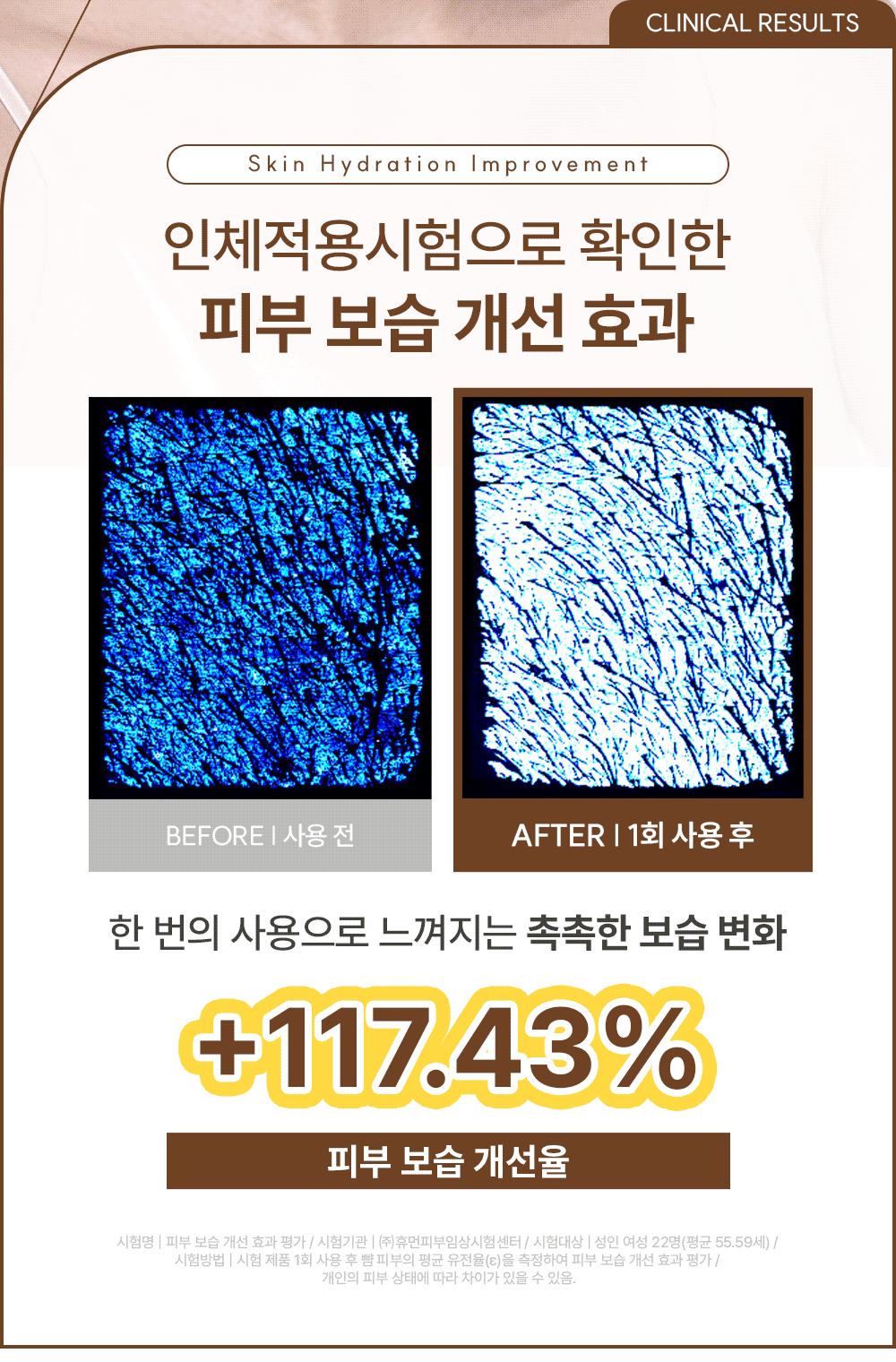 히알루론산 보르프로샷 딥 실크 볼륨 핏 하이드로겔 마스크 34g*4ea