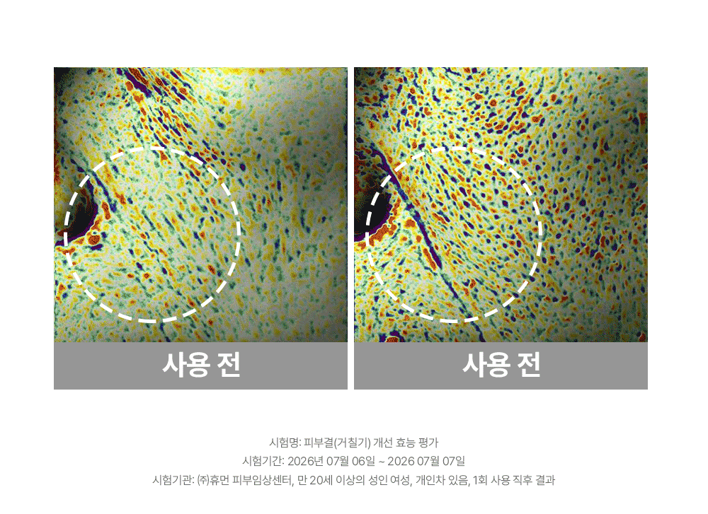 히알루론산 보르프로샷 딥 실크 볼륨 핏 하이드로겔 마스크 34g*4ea 복제