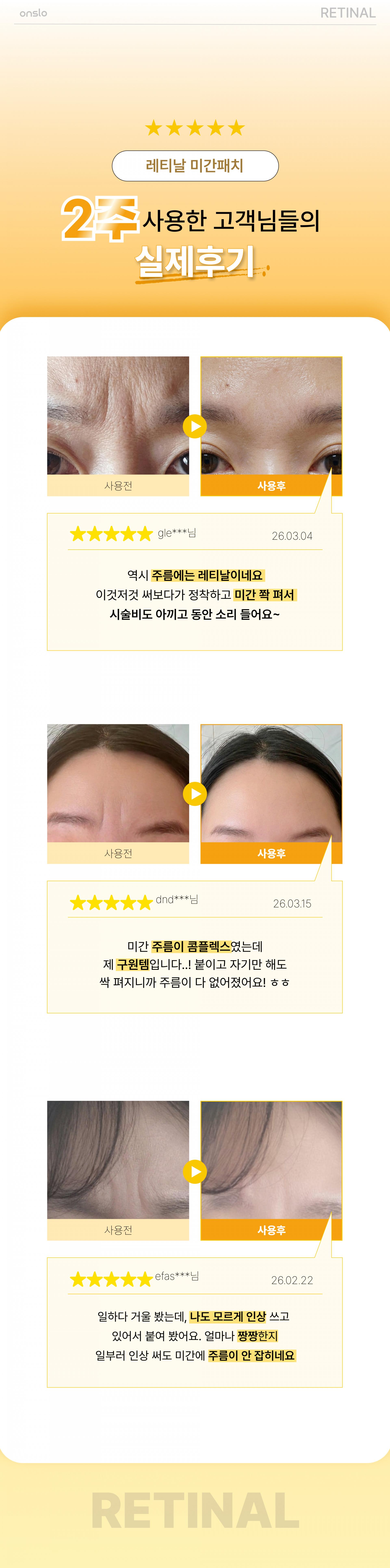 온슬로 레티날 미간주름패치_0.28g*5, 45매