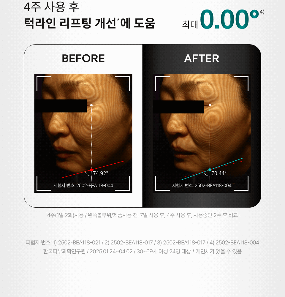 닥터나인틴 포어엑스좀 레디알엔 엑소좀 앰플 15ml