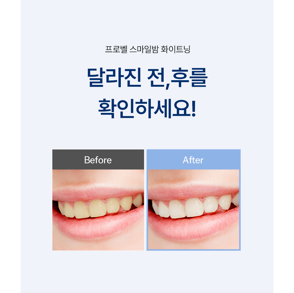 악세사리 상품 이미지-S1L8