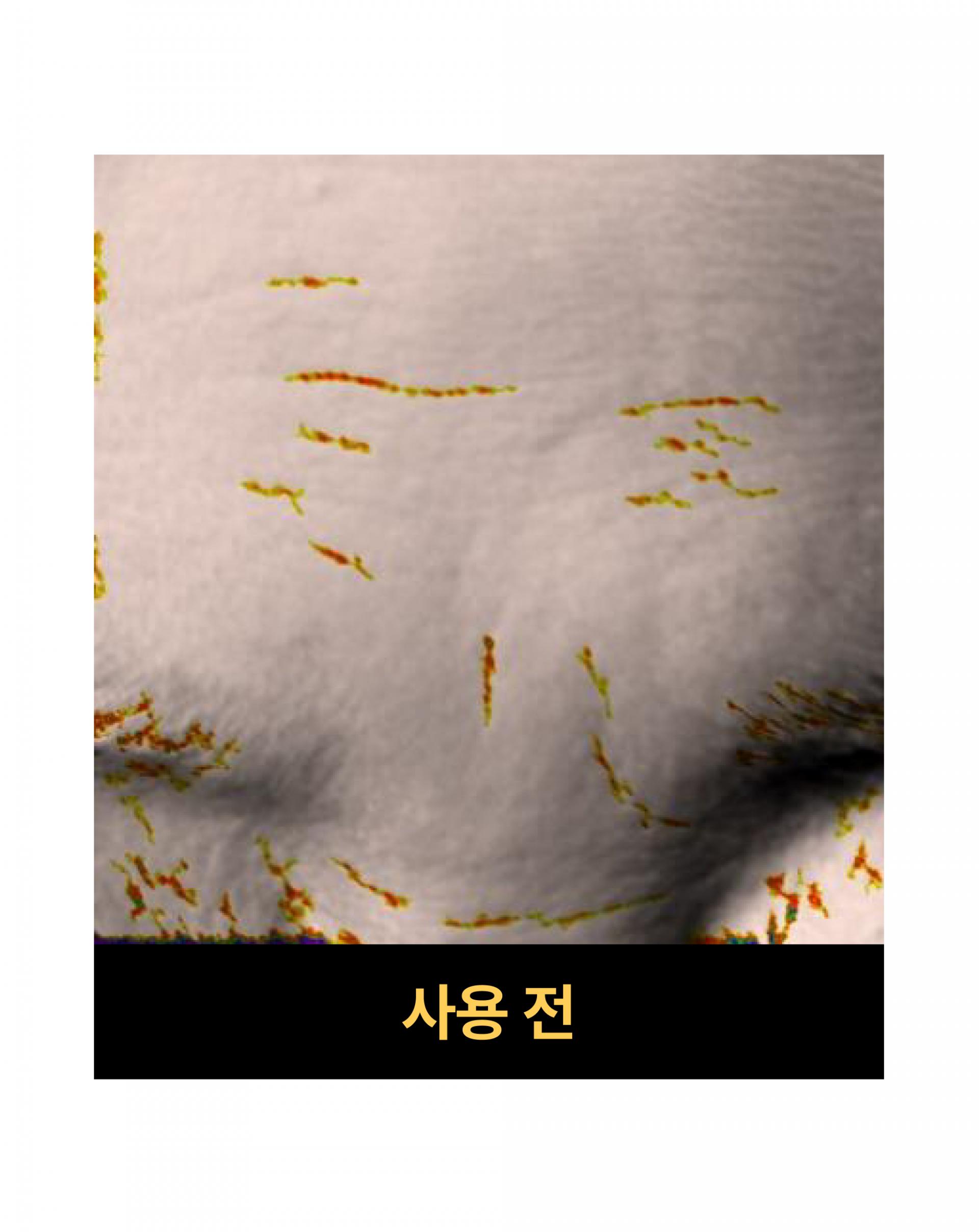 온슬로 레티날 미간주름패치_0.28g*5, 45매