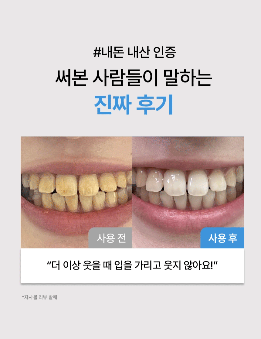 노도르 미백치약