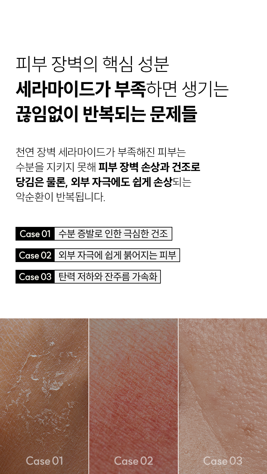 언핸서 세라마이드 콜라겐 마스크