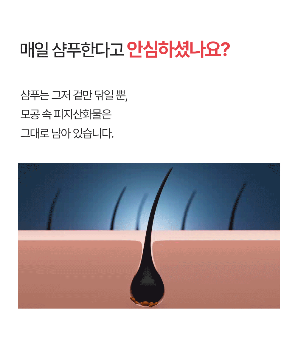 포셰리 비울 두피스케일러
