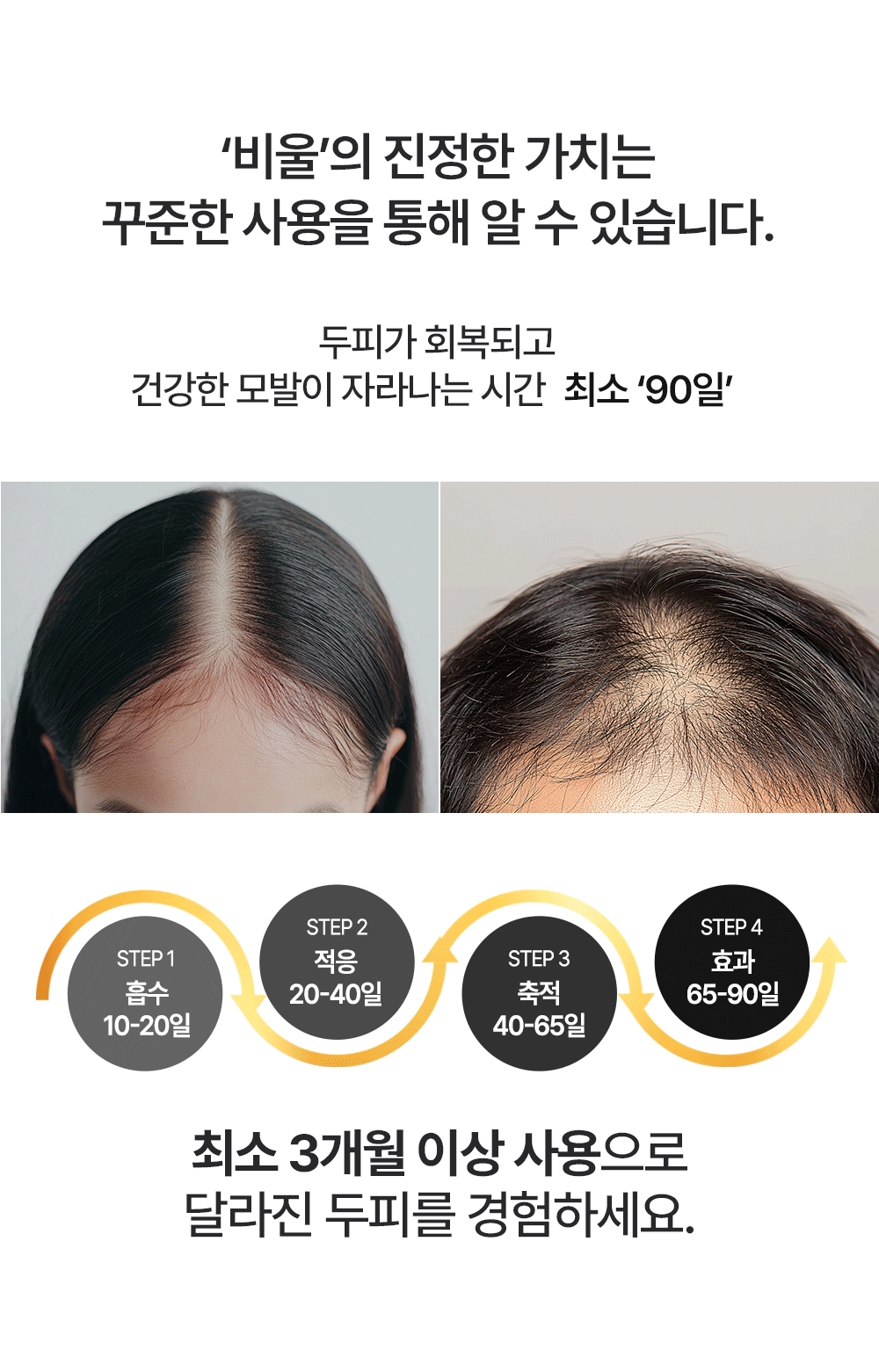 포셰리 비울 두피스케일러