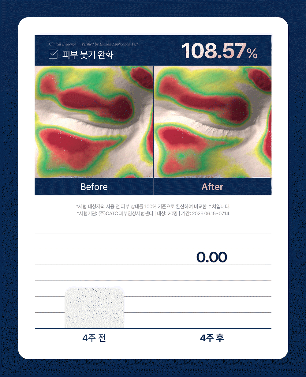 [단7일, 비밀링크] 이퀄로지 C-텐션 아이 패치