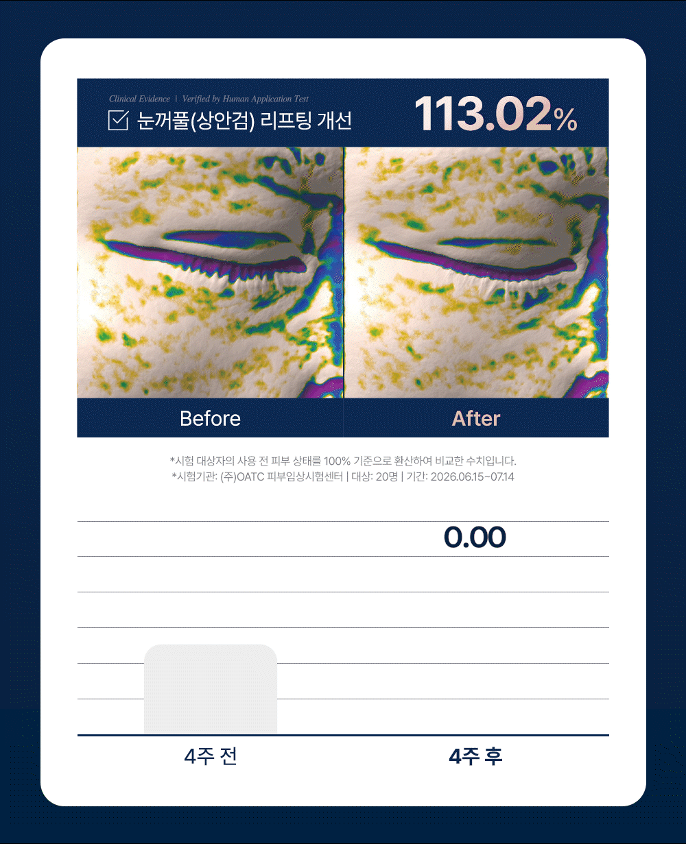 [단7일, 비밀링크] 이퀄로지 C-텐션 아이 패치