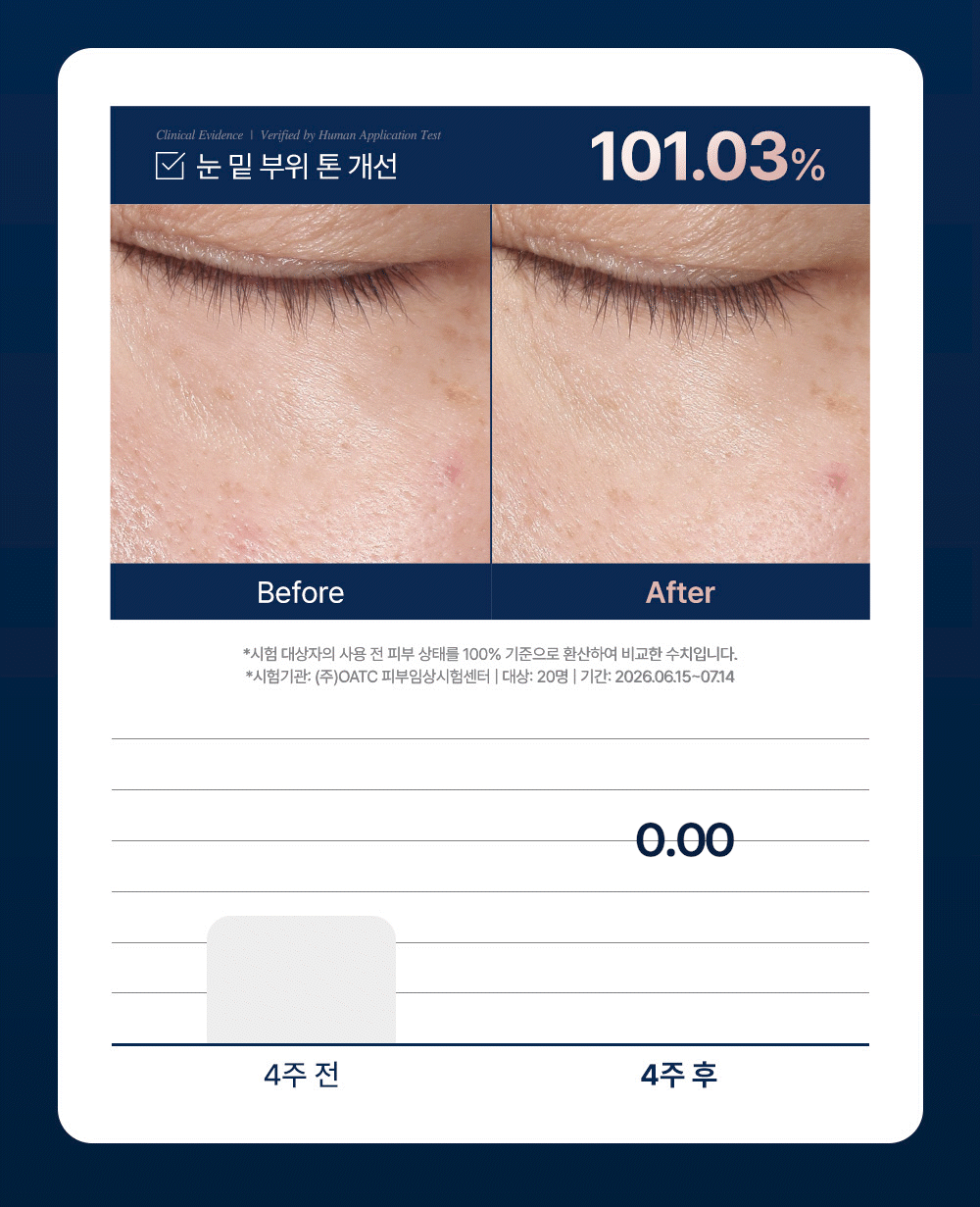 [단7일, 비밀링크] 이퀄로지 C-텐션 아이 패치