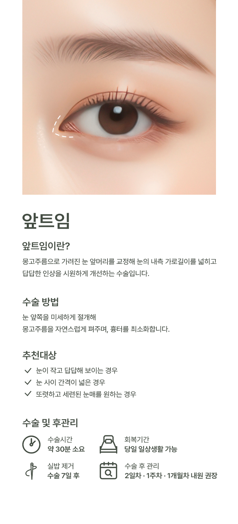 앞트임
