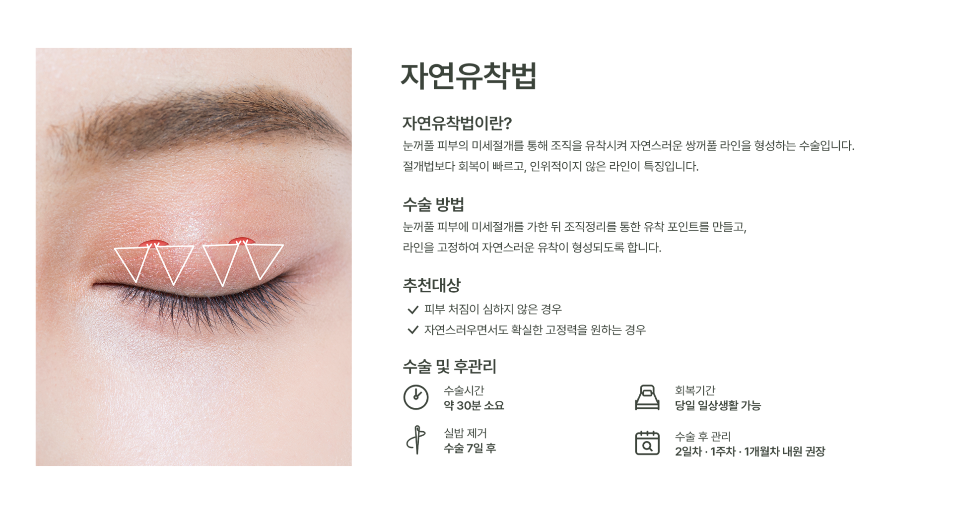 자연유착법 이미지