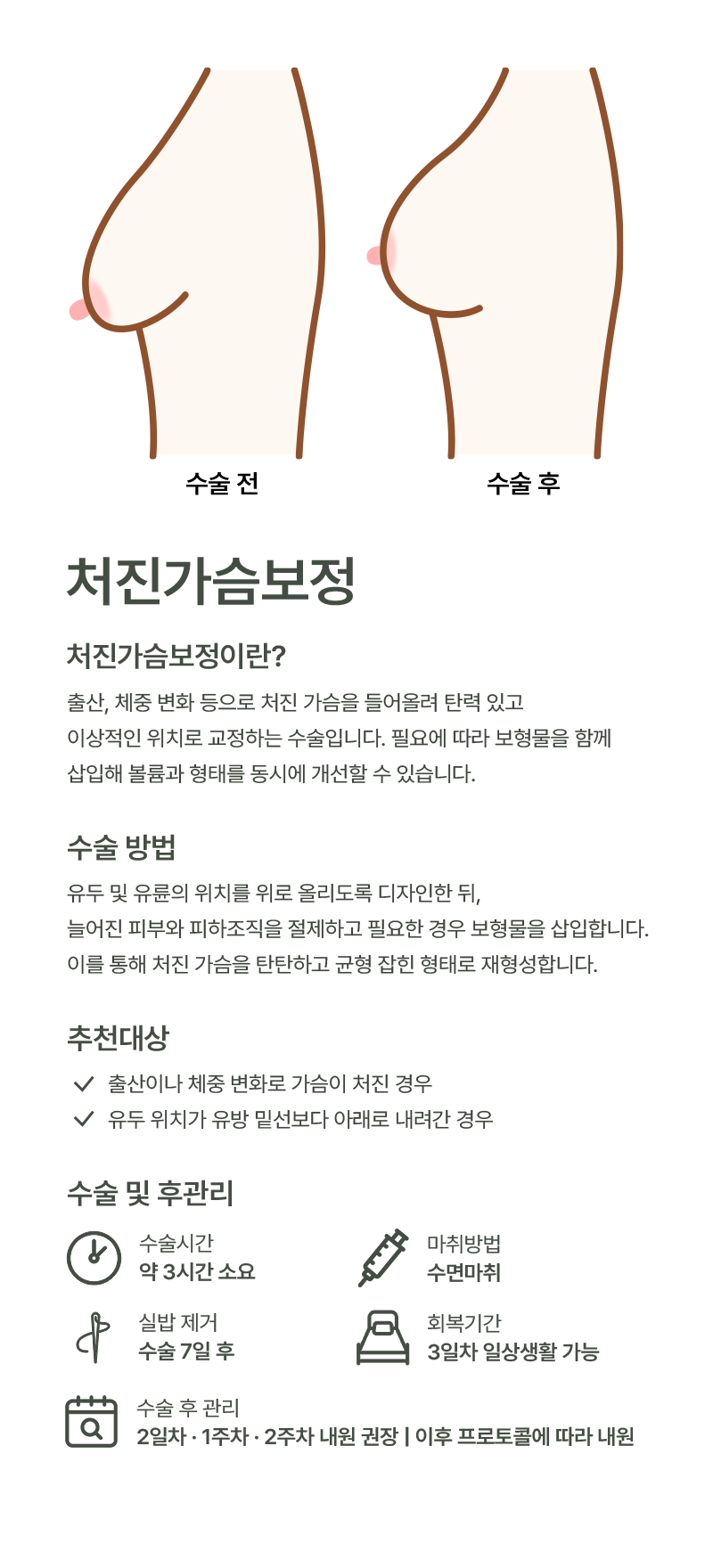 처진가슴보정 이미지