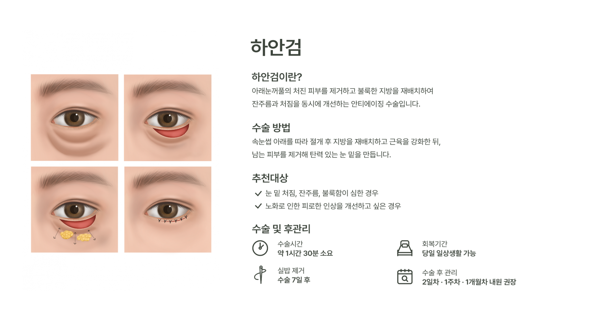 하안검 이미지