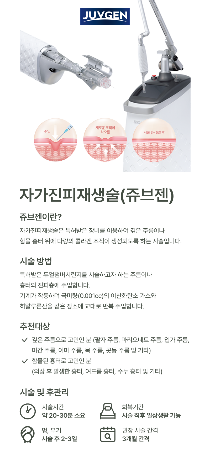 쥬브젠1