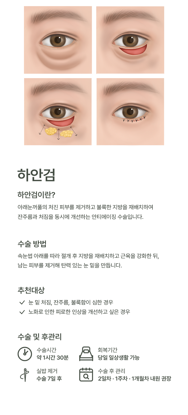 하안검 이미지