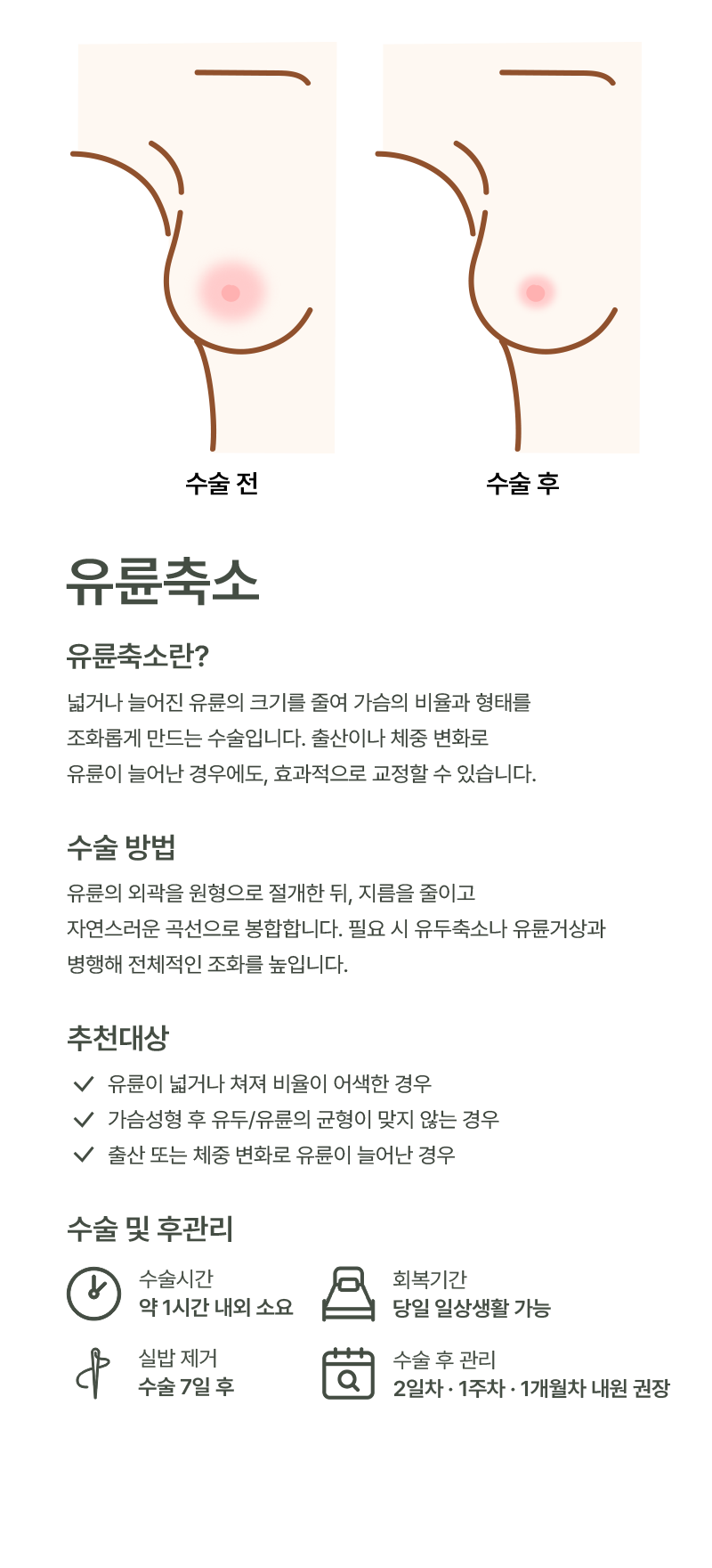 유륜축소 이미지
