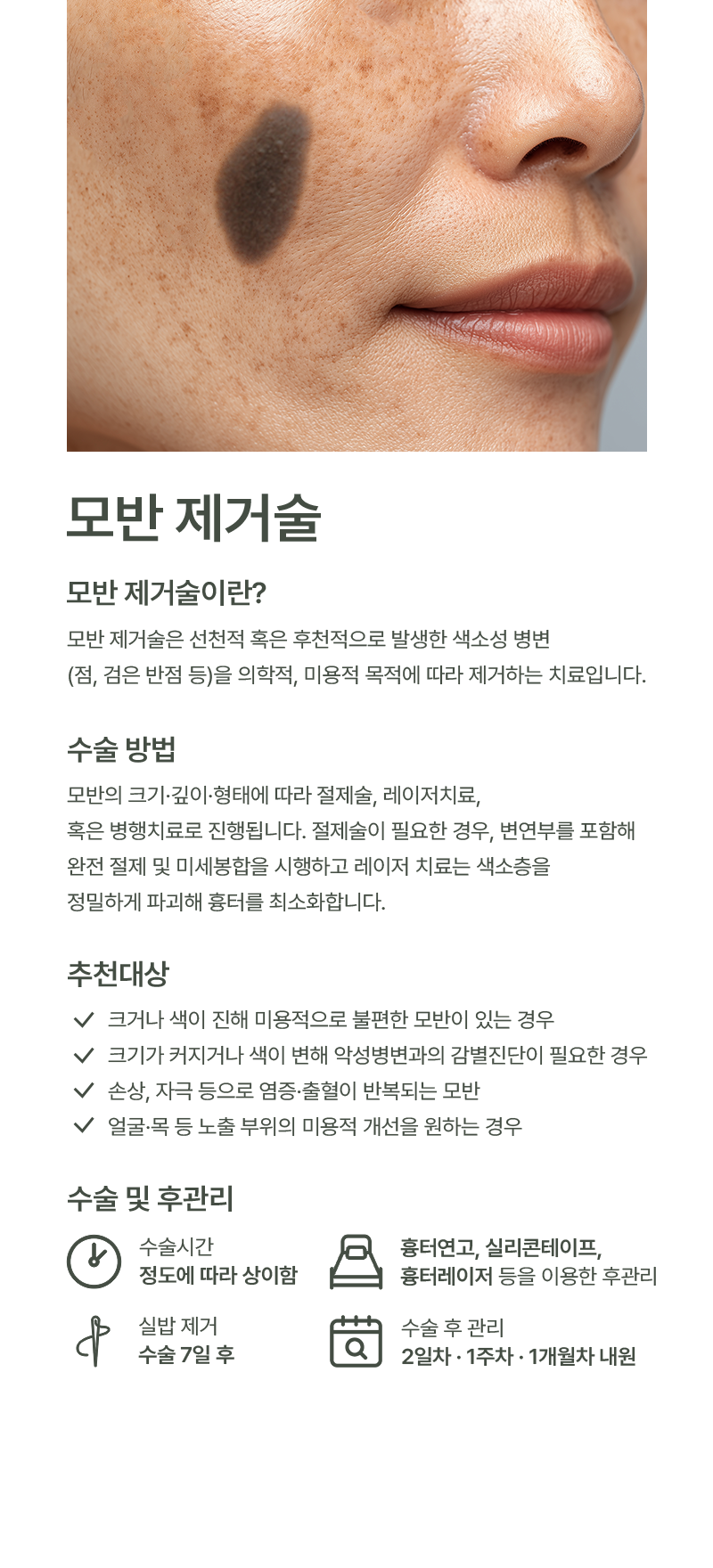 모반 이미지