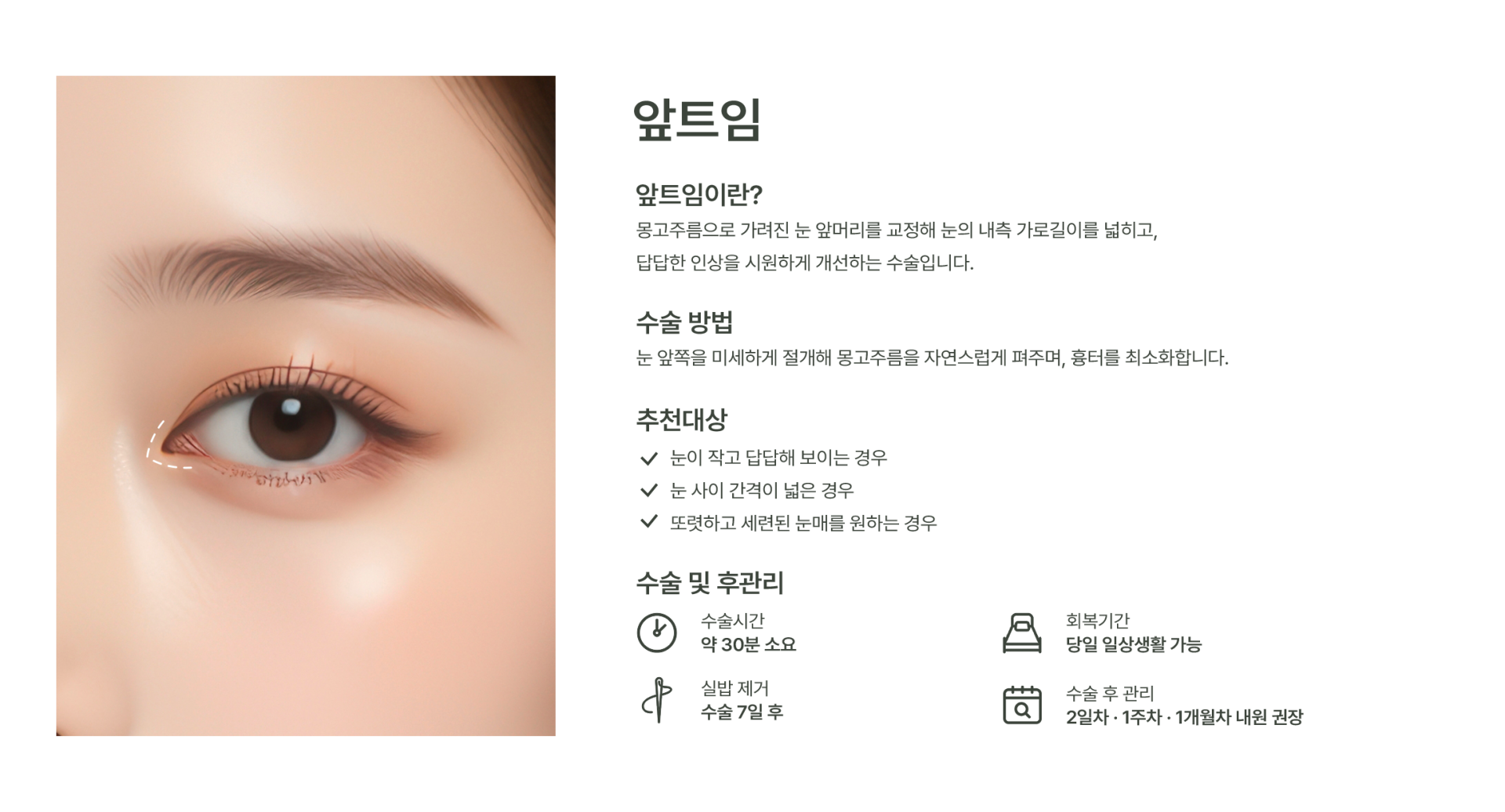 앞트임 이미지