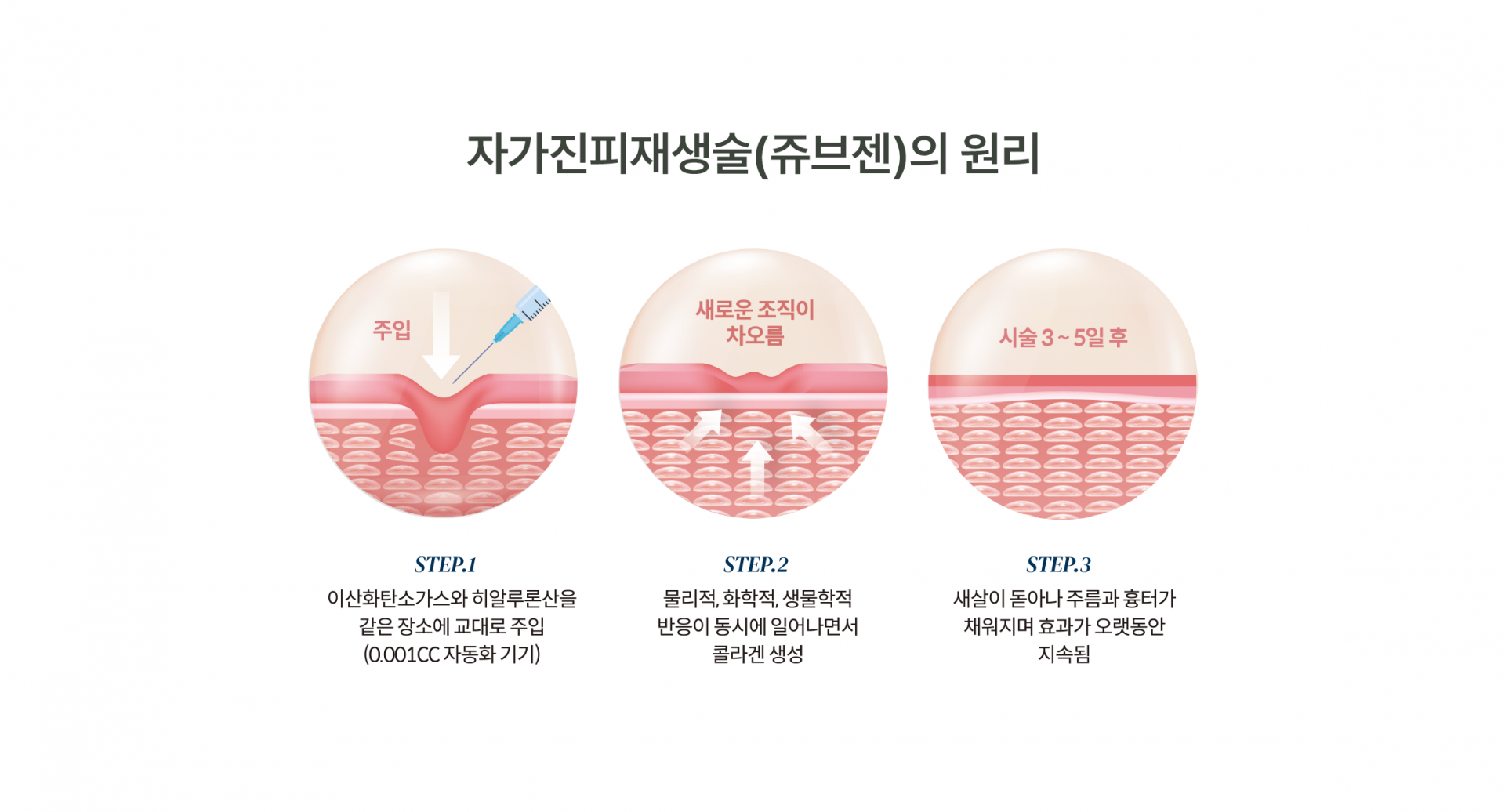 쥬브젠 이미지2