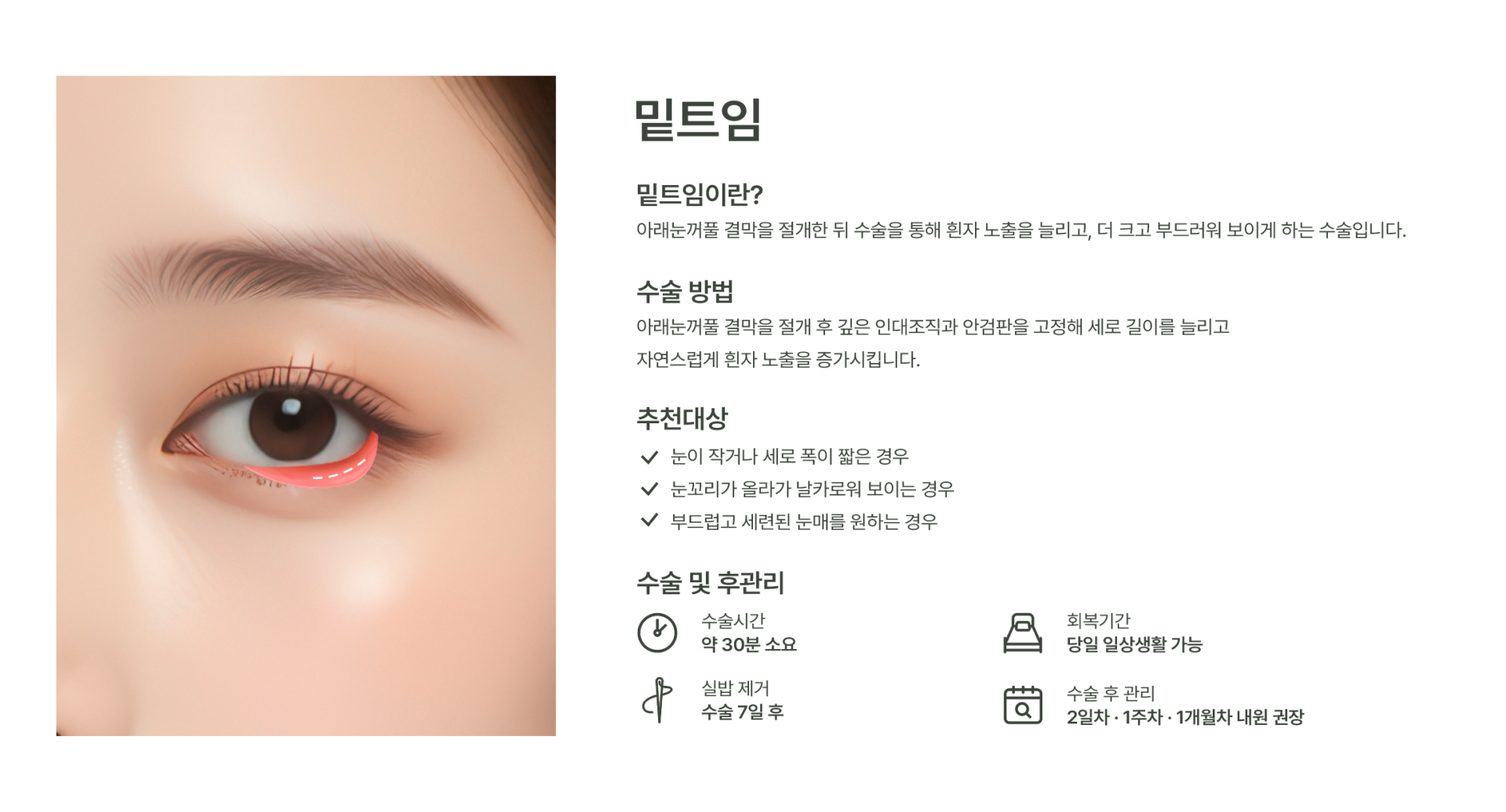 밑트임 이미지