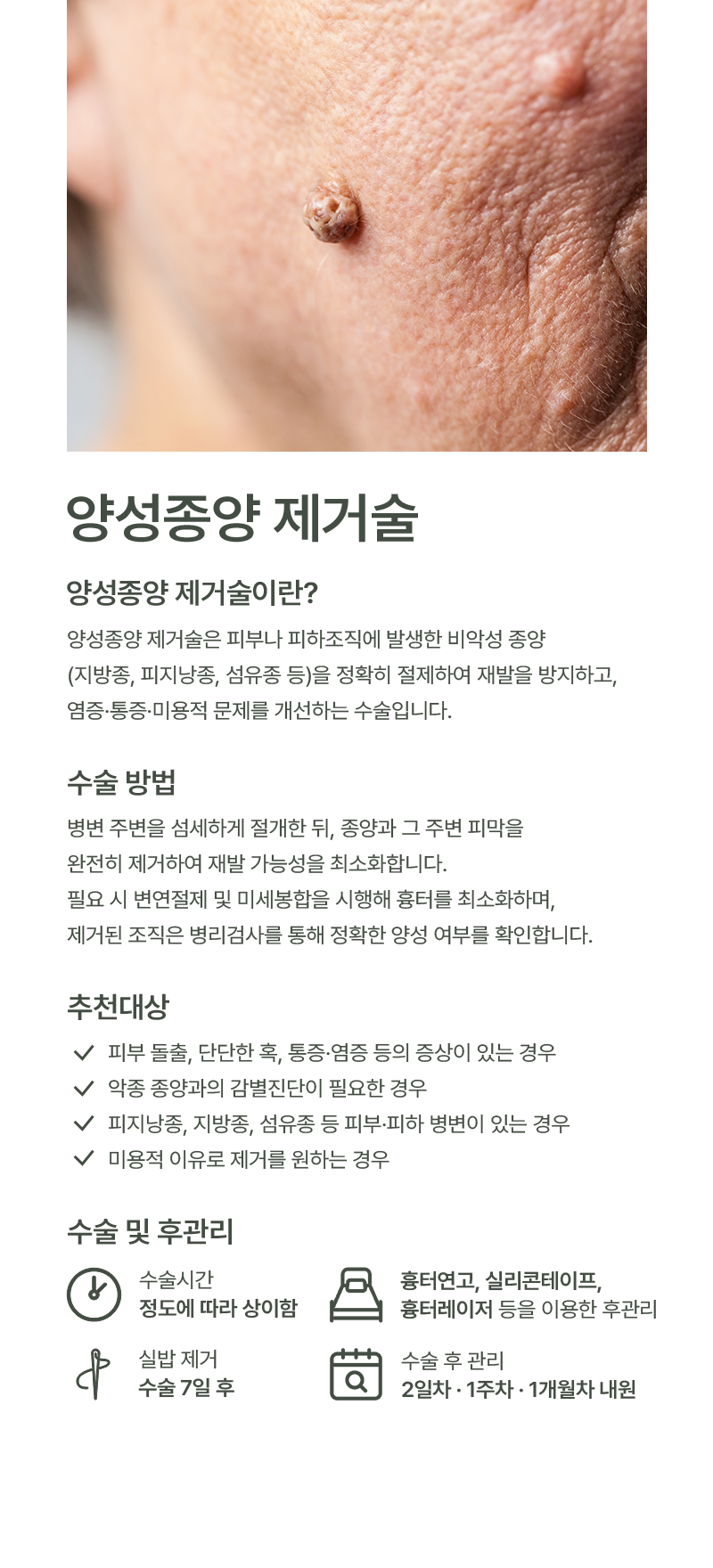 양성종양 이미지