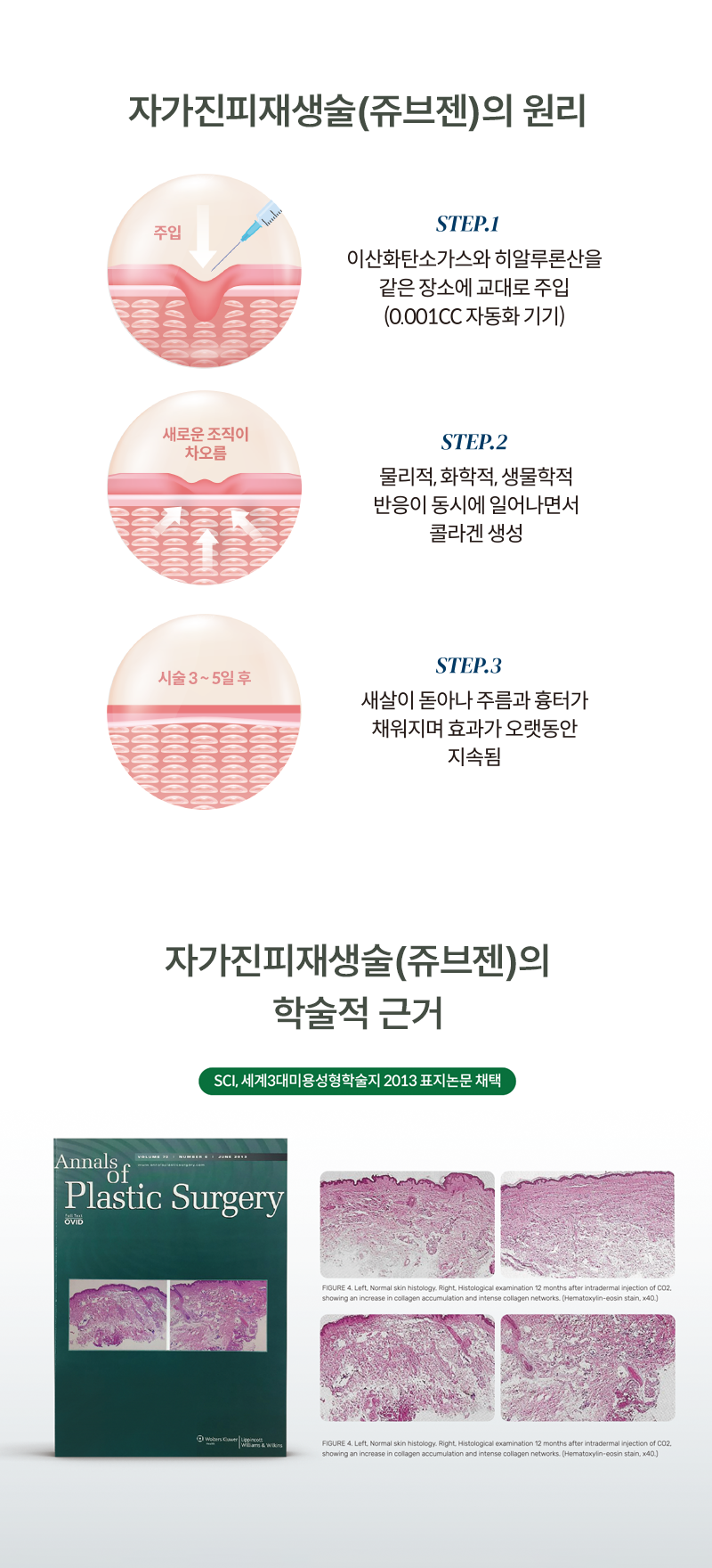 쥬브젠2