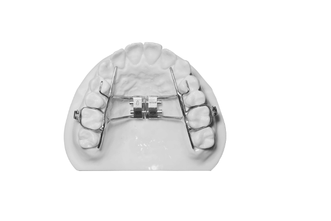 부분교정 MTA 이미지