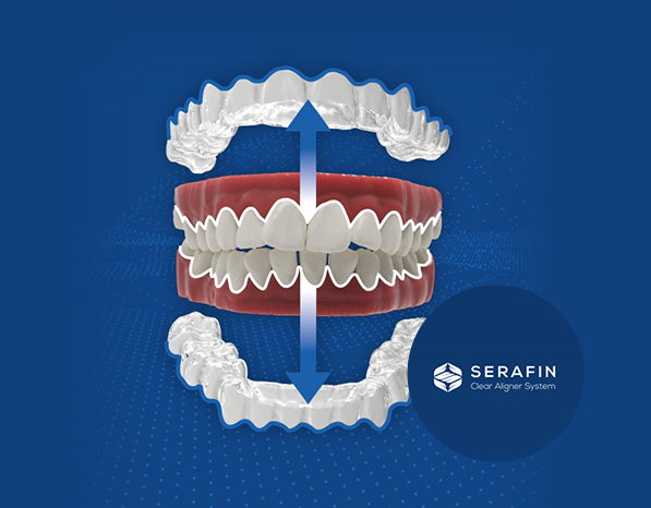 세라핀 교정 이미지