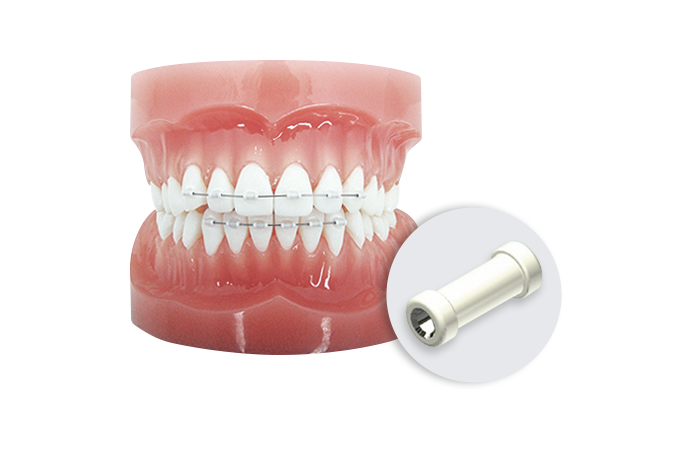 부분교정 MTA 이미지