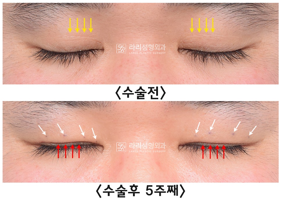 주4.jpg