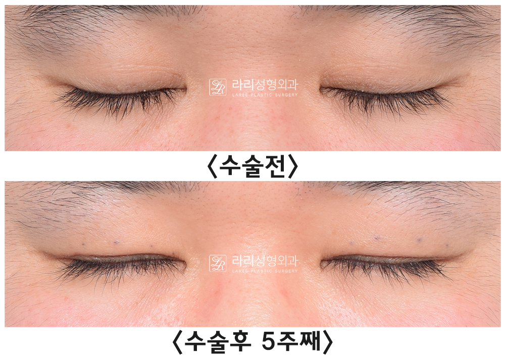 주3.jpg