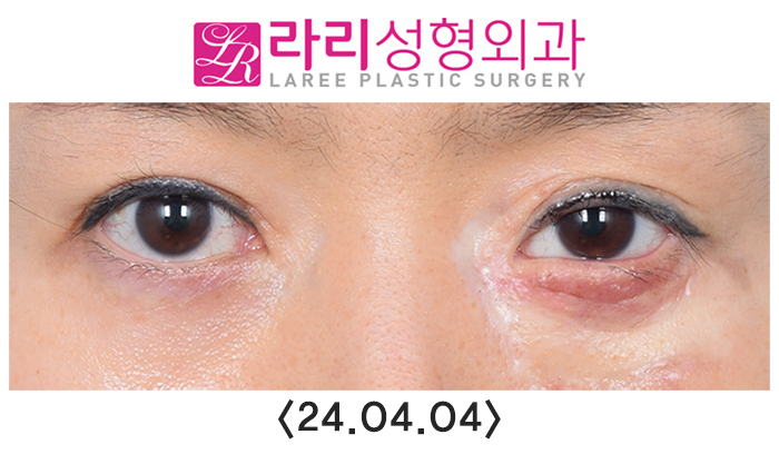 임4.jpg