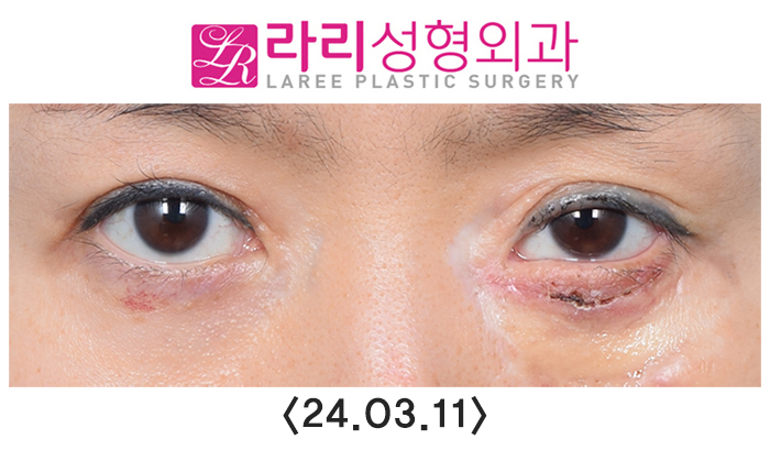 임3.jpg