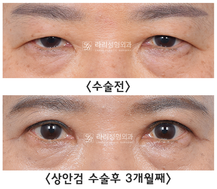 상1.jpg