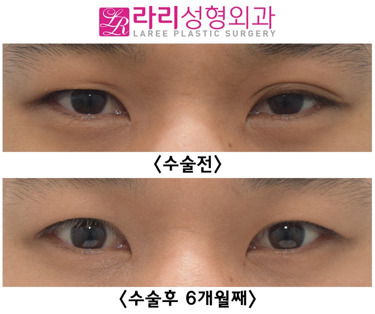 영5.jpg
