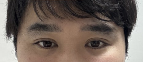 수술전.jpg