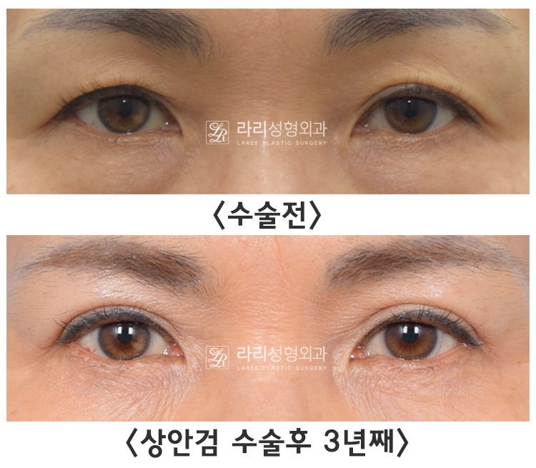 상4.jpg