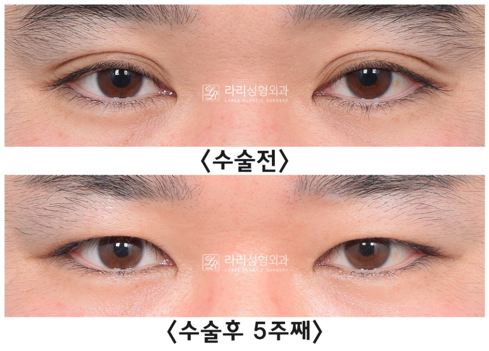 주1.jpg