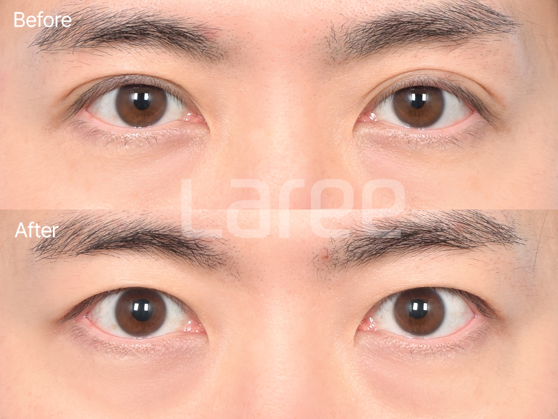 53082d8232567.png