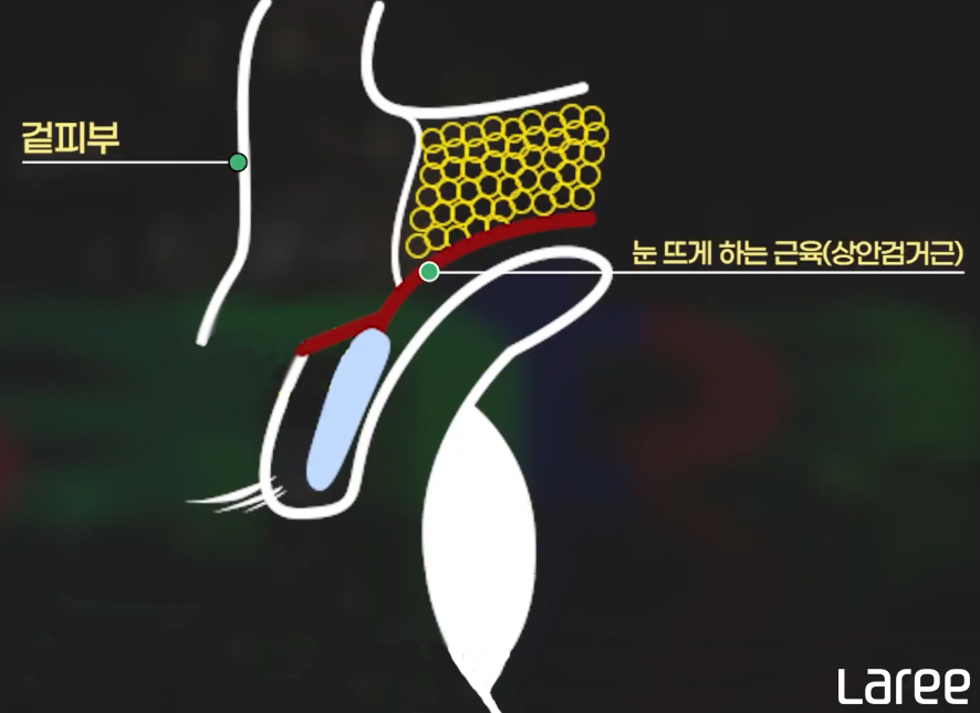 5714b89471ae5.png